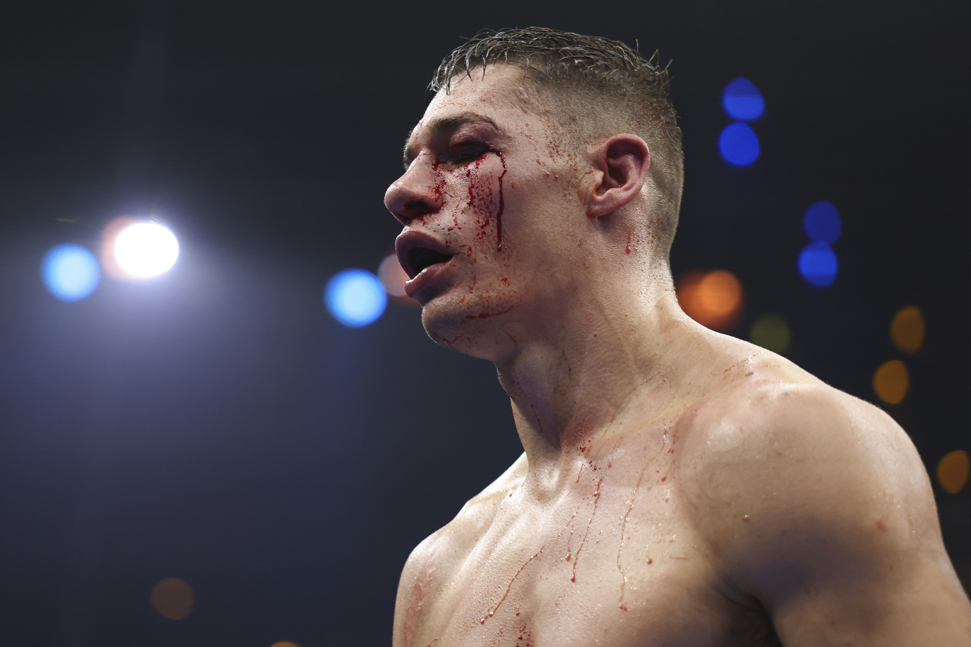 Chris Billam-Smith kizárta a Jack Massey elleni visszatérő meccset